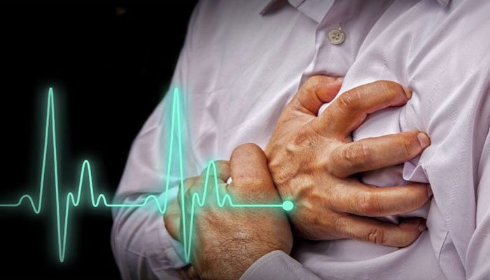 Heart Attack